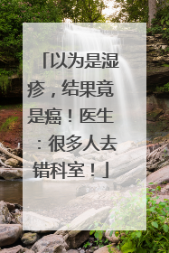 以为是湿疹，结果竟是癌！医生：很多人去错科室！